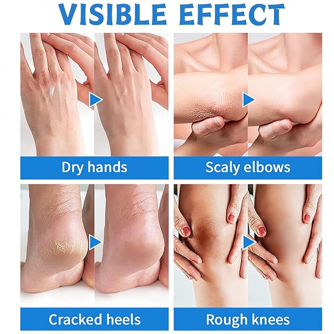 2PCS Foot Cream Set – 60% Urea Foot Cream & Peach Scent Heel Balm Stick – Exfoliating & Moisturizing Foot Care Duo for Dry Cracked Heels & Feet, 1.41oz Each