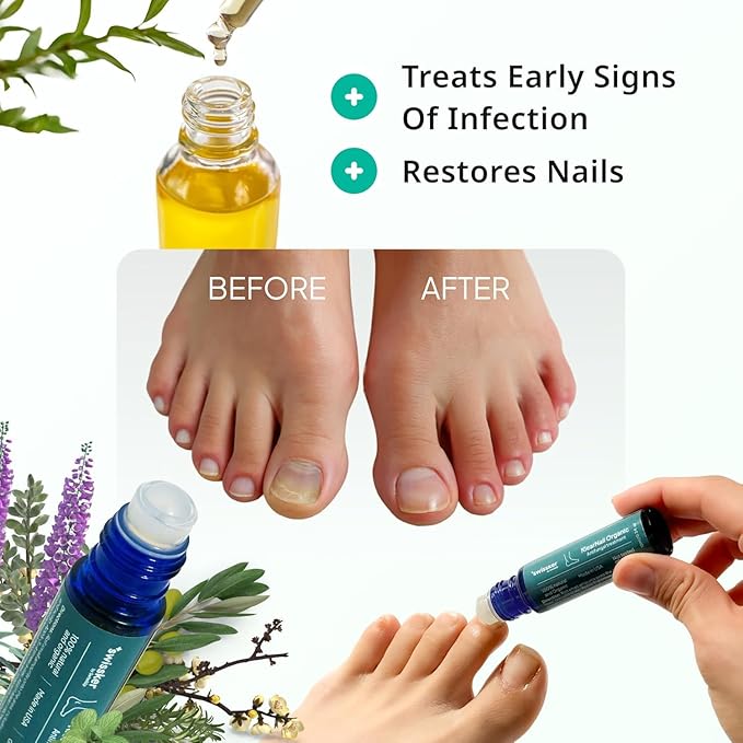 Swissklip Medi-Care Toenail Stick I KlearNail Treatment | Natural Solution for Healthy Nails I Suitable For Foot, Toe, and Fingernail I For Brittle Toenails – 10ml / 0.3 Fl. Oz. Pack 2 - Made in USA