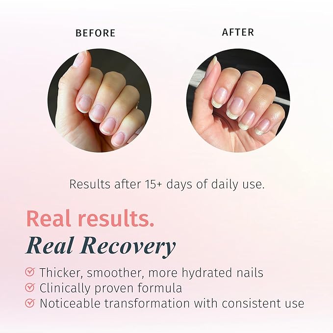 duri Rejuvacote 1 Nail Growth System and duri Drop'n Go Polish Drying Drops Combo