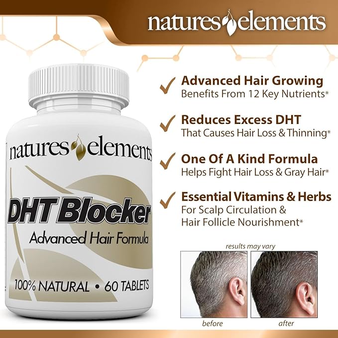 DHT Blocker – Herbal Formula with Saw Palmetto, Fo-Ti & Beta-Sitosterol – Supports Hair Regrowth & Gray Hair Reversal – Non-GMO, Vegetarian - 60 Tablets - Pack of 3