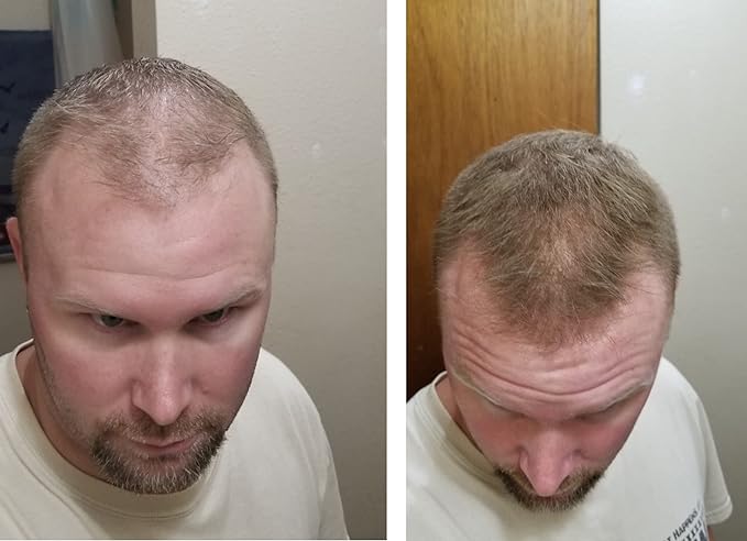 Quick Fix For Thinning Hair and Bald Spot. Get 10X Fuller Hair Instantly. All-Natural Hair Building Fiber For Hair. Trial Size (10-Day Supply). Light Brown