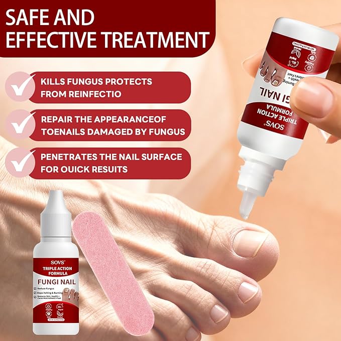 Toenail Treatment,Gentle Formula, Effectively Improves Nails for a More Beautiful Appearance (1Pcs, 1 oz)