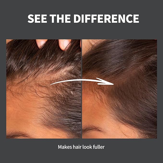 Hairline Powder 24H Stain-Proof, Root Touch Up Hair Color for Gray Coverage,Bald Spot Concealing Hair Shadow Powder for Women & Men,Natural-Looking (Light Brown)