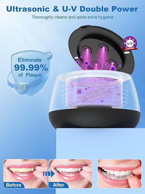 KUNPHY 2026 Ultrasonic Retainer Cleaner Machine, 48kHz Dental Cleaning Pod for Braces, Night Guard, Mouthguard, Toothbrush, Jewelry, 7Oz Denture Cleaner Machine