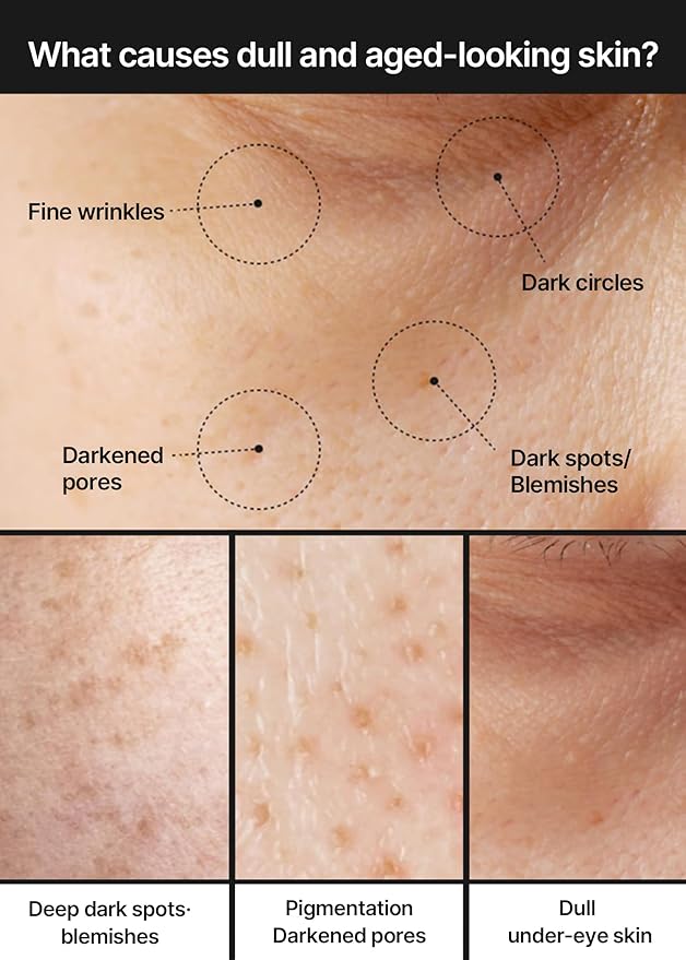celimax Pore+Dark Spot Brightening Cream | with Niacinamide, Tranexamic Acid, TXA Cream, Pore Minimizer, Non-Irritating, Hydrating, For Sensitive Skin, Holiday Gift, 35ml