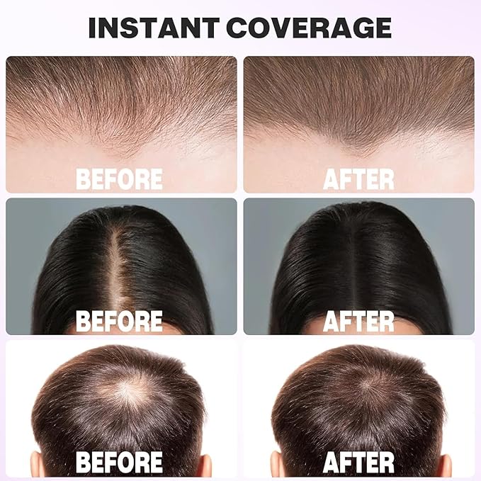 Acomler Instantly Root Cover Up Hairline Powder, 0.35 Ounce Root Touch Up Hair Color, Gray Hair Cover Up Hair Fibers, Hair Powder for Women Men with Eyebrows, Beard Line, Bald Spots (Light Brown)