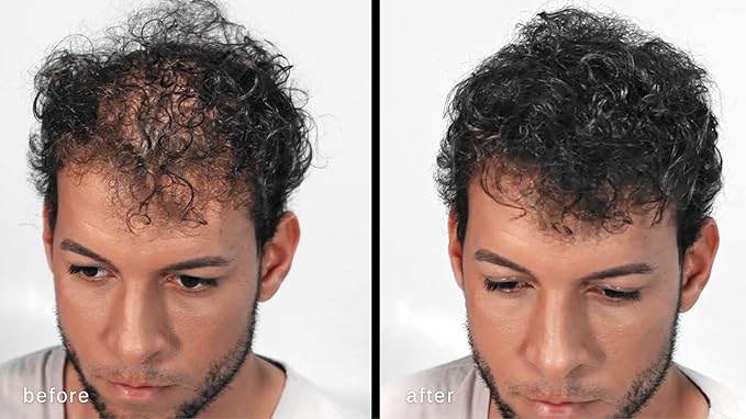 Volumizing Hair Fibers with real Keratin for Thinning Hair/Hair Loss – Dermatologist Tested and Certified Hypoallergenic - 60 days + supply - Multiple Colors Available (Gray)