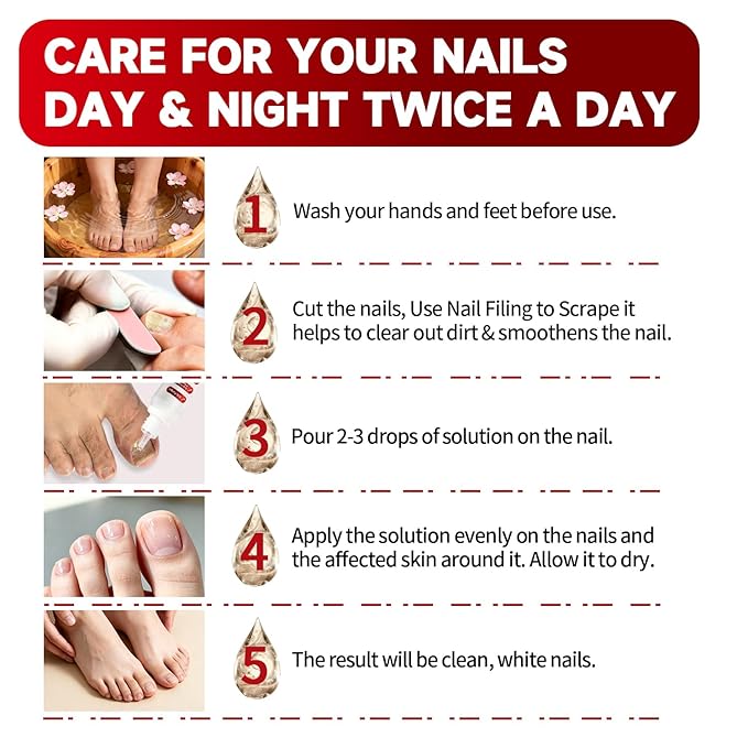 DERMFREE Fungi Nail Toenail Treatment,Gentle Formula, Effectively Improves Nails for a More Beautiful Appearance