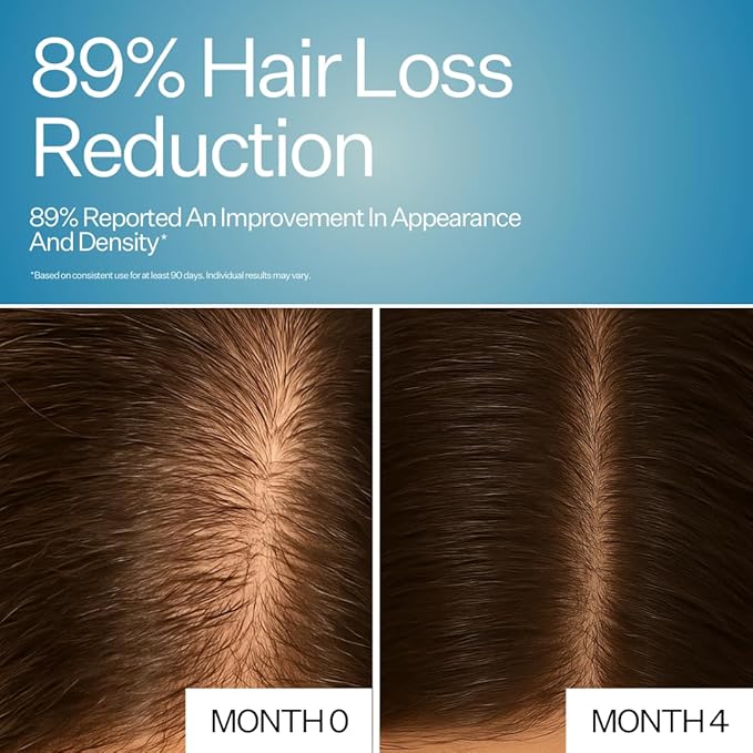 AM/PM Hair Growth Serums for Women & Men – Redensyl Capixyl Procapil GHK-CU Multi-Peptide & Stem Cell Formula| DHT Blocker Topicals | Regrowth Treatment | Hair Loss Support Bundle | Follicle Spray