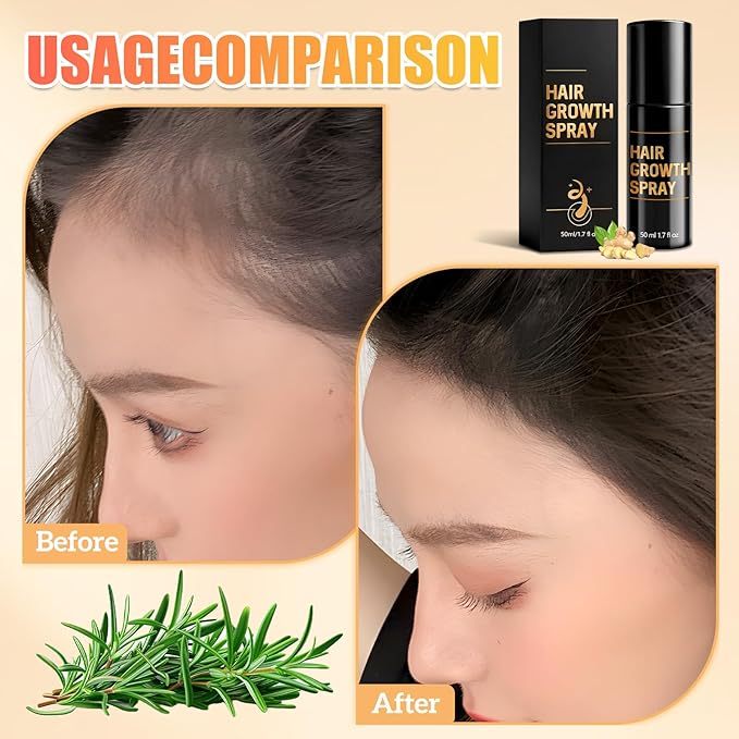 Hair Growth Spray, Hair Growth Spray for Men and Women, Promotes Thicker Fuller Hair –All Hair Types