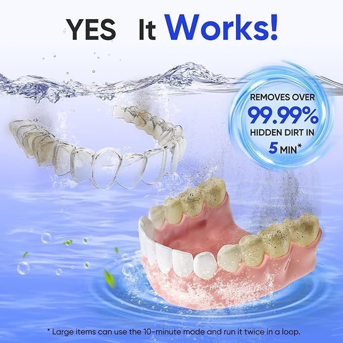 MySmile Dental Ultrasonic Retainer Cleaner Machine- 45kHz UV Denture Cleaner with 200ML Capacity for Aligner, Braces, Mouth Guard, Night Guard, Portable Dental Cleaning Pod with Digital Timer (White)