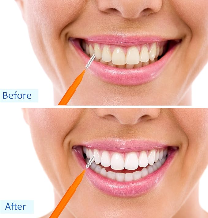 Patelai 100 Pieces Braces Brush for Cleaner Interdental Brush Toothpick Dental Tooth Flossing Head Oral Dental Hygiene Flosser Toothpick Cleaners Tooth Tool(White, Orange, Blue,Proper Size)
