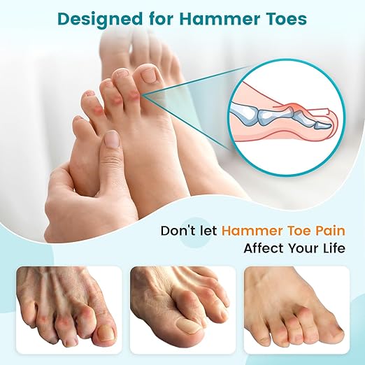 Hammer Toe Straightener Corrector Splint Brace for Women fit 2nd 3rd and 4th Toes - (M-Blue) - 1 Pair