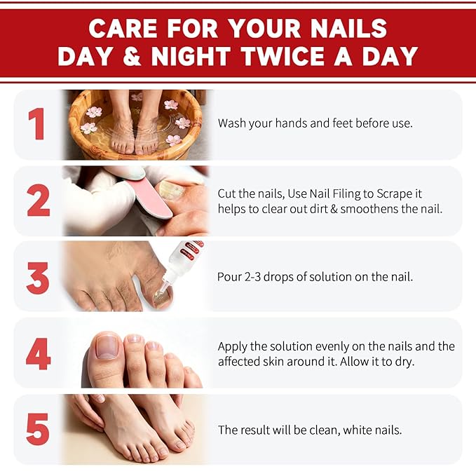 Fungi Nail Toenail Treatment Extra Strength,Toenail Renewal Serum, Nail Conditioning Solution for Thick&Discolored Nails, Quick-Dry Dropper, Safely & Gently for Healthier Nails,