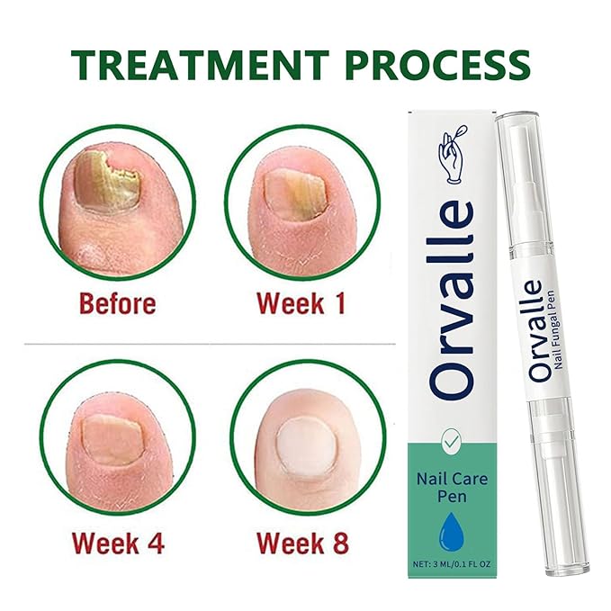 Orvalle Nail Fungus Pen, Nail Growth Treatment Repair Serum Twist Pen Activator for Repair & Strengthener (3)