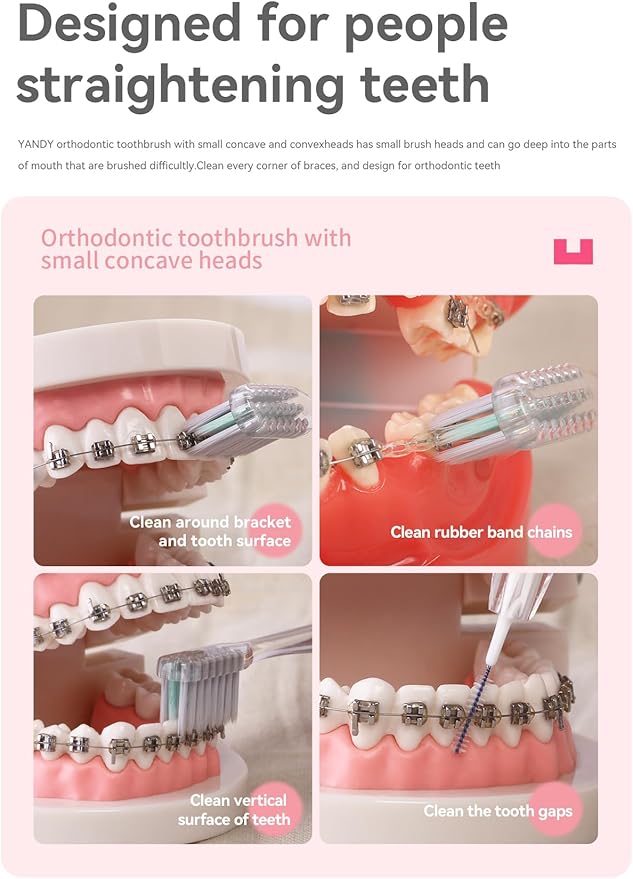 YANDY Concave Orthodontic Toothbrush for Braces Brackets, Pack of 3,Tail Self-Contained Interdental Brush, Soft Bristles