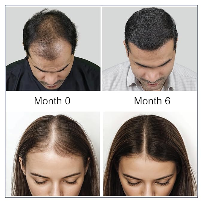 Hair Growth Supplement | 360 Tablets - 6 Months Supply | Support Thicker, Fuller Healthy Hair Growth For Men & Women - Advanced Hair Growth 17 in 1 Formula
