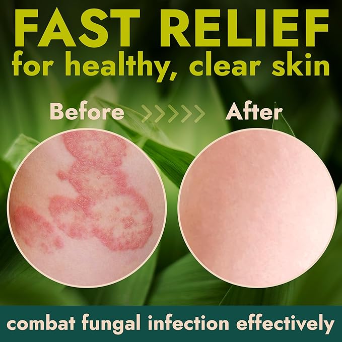 Antibacterial Body Lotion | Kills 99.9% of Germs & Bacteria | Body Lotion for Women & Men Helps Sanitize Skin | Infused with Botanical Extracts | Fresh, Soft & Moisturized Skin | 4 fl oz