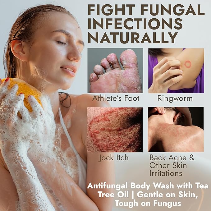 Terramed Just Think Comfort Antifungal & Antibacterial Soap & Body Wash with Tea Tree Oil | Treats Ringworm, Back Acne, Eczema & Jock Itch | Antibacterial Body Soap For Men And Women (16.9 oz)