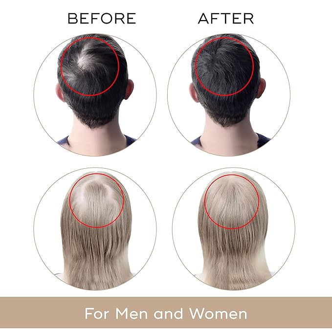 USA Dekohair Hair Regrowth Serum - Stops Hair Thinning, Promotes Growth, Increases Root Volume