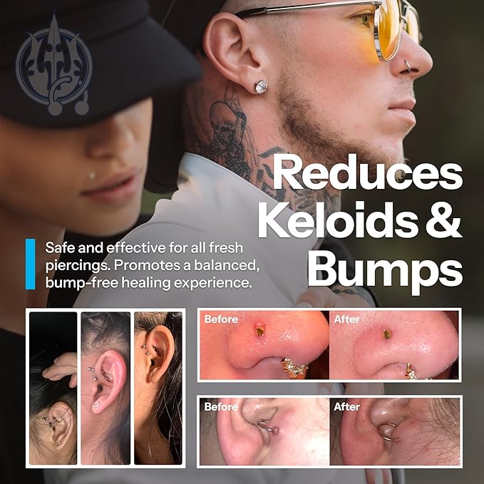 H2Ocean Piercing Aftercare Spray and Keloid Bump Removal– Sea Salt Spray for Body and Facial Piercings– Ear, Nose,Navel,Oral & Body Piercing Cleaner, Aftercare Solution for New Piercings–4oz,Pack of 3