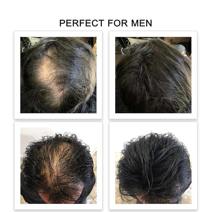 FEBRON Hair Fibers For Thinning Hair GRAY For Women & Men Hair Loss Concealer Hair Powder Volumizing Based 100% Undetectable & Natural - Bald Spots Filler (30 Gram, Gray)