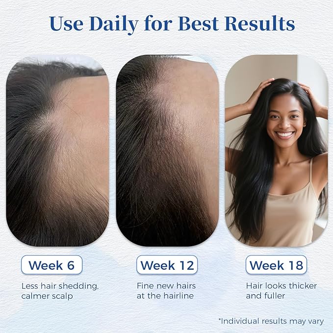 Hair Growth Serum Roll On 25ml with Saw Palmetto, Rosemary & Pea Extract，Helps Support Thicker, Fuller Hair Appearance，Clean, Non-Greasy Hair Loss Support for Men & Women Pack of 3