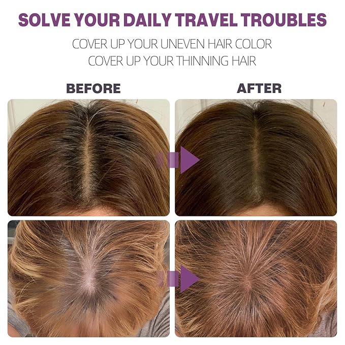 Hairline Powder Instantly Conceals Hair Loss, Root Touch Up Hair Color Powder, Hair Toppers for Women Men, Hair Fibers for Thinning Hair, Root Cover Up lasting 24 hours (Dark Blonde, 0.35)