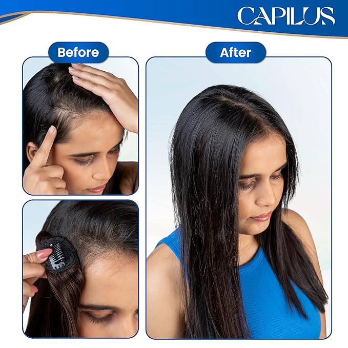 Capilus Invisible Hair Patch (Natural Brown, 12 Inch 1 Pack) | 100% Indian Human Hair Extensions for Women & Girls | Natural-Looking Volumizer | Undetectable, Durable & Non-Damaging Clip Mechanism
