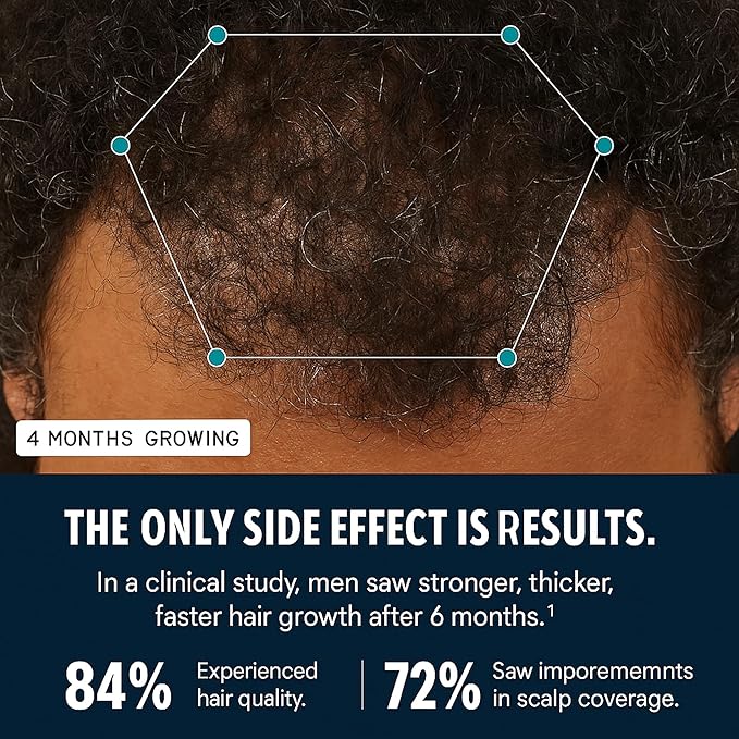 Men's Hair Growth Supplement – Clinically Tested Hair Growth Vitamins for Men, Thicker Hair & Scalp Coverage, Hair Regrowth Support for Men – Stronger, Fuller Hair – 1 Month Supply