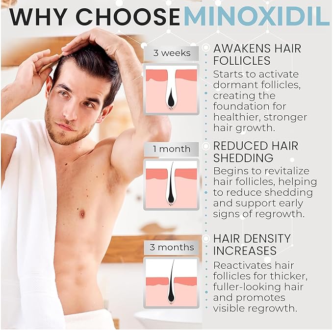 Remixidil Men’s 5% Minoxidil Foam | Hair Regrowth Treatment for Men | Clinically Proven Formula for Hair Loss and Hair Growth | No Scalp Irritation | 3-Month Supply