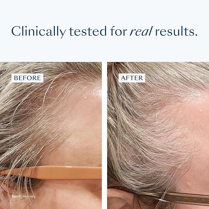 eSalon Thinning Hair Bundle, Root Touch Up + Brow Powder (Strawberry), 2% Minoxidil Hair Regrowth Treatment, Densifying Scalp Serum with Procapil + Redensyl