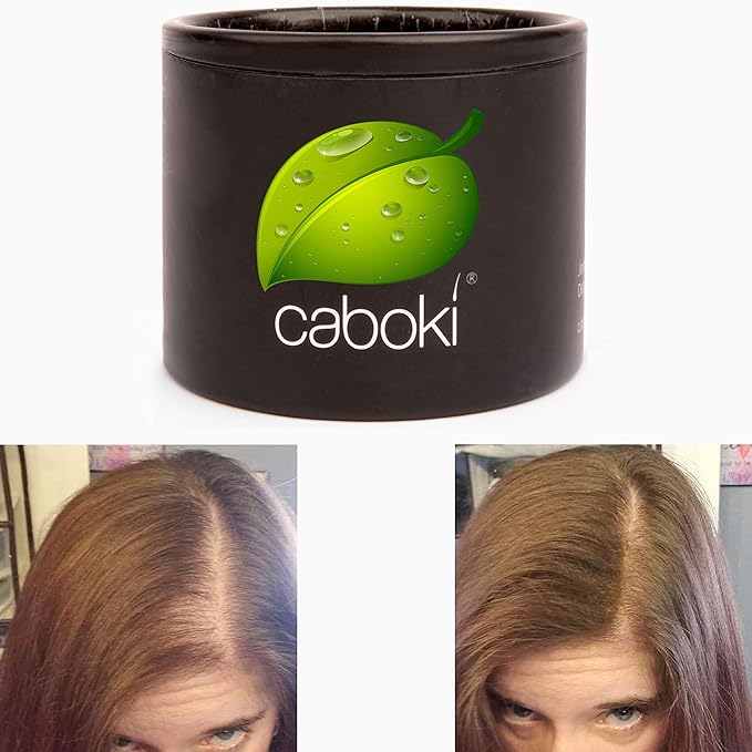 Hair Building Fiber. Cover Bald Spot and Thinning Hair Instantly. 10X Fuller Hair. All-Natural, Organic Hair Loss Concealer. Trial Size (10-Day Supply). Medium Brown