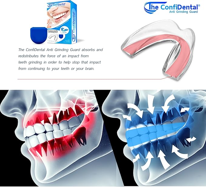 The ConfiDental Mouth Guard for Teeth Grinding and Clenching - Moldable Dental Nightguard Protection for Mild to Heavy Teeth Grinders at Night - 5-Pack (3 Regular, 2 Heavy-Duty)