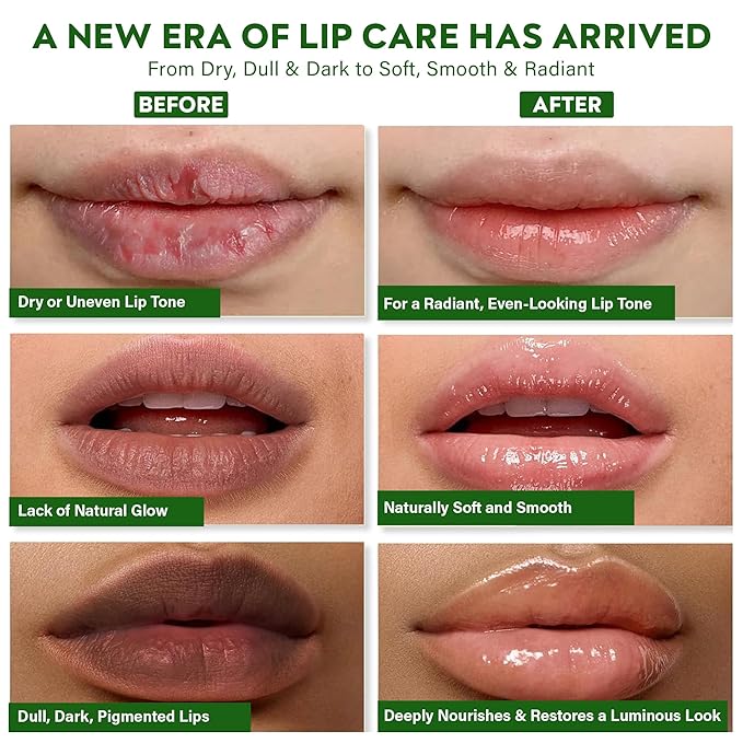 Ayurvedic Vegan Lip Brightening Balm for Dark & Smokers' Lips | Deeply Hydrating, Moisturizing & Rich- Antioxidants Botanical Lip Care