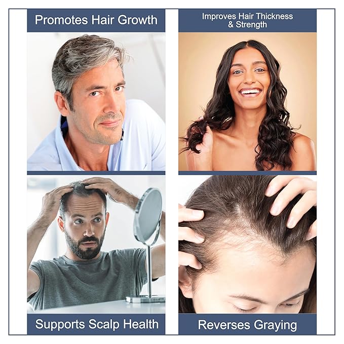Hair Growth Supplement | 360 Tablets - 6 Months Supply | Support Thicker, Fuller Healthy Hair Growth For Men & Women - Advanced Hair Growth 17 in 1 Formula