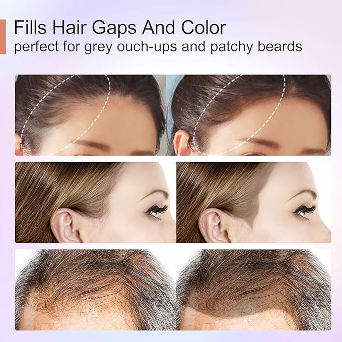 Acomler Root Cover Up Powder for Thinning Hair, Grey Coverage, and Bald Spots - Medium Brown for Hairline Shadow and Beard Line