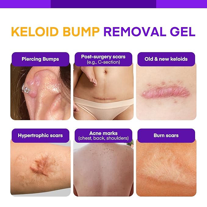 Keloid Bump Gel, Scar Prevention, Skin Renewal, Advanced Silicone Keloid Cream for Piercing Bumps 0.71 oz (2 Pack)