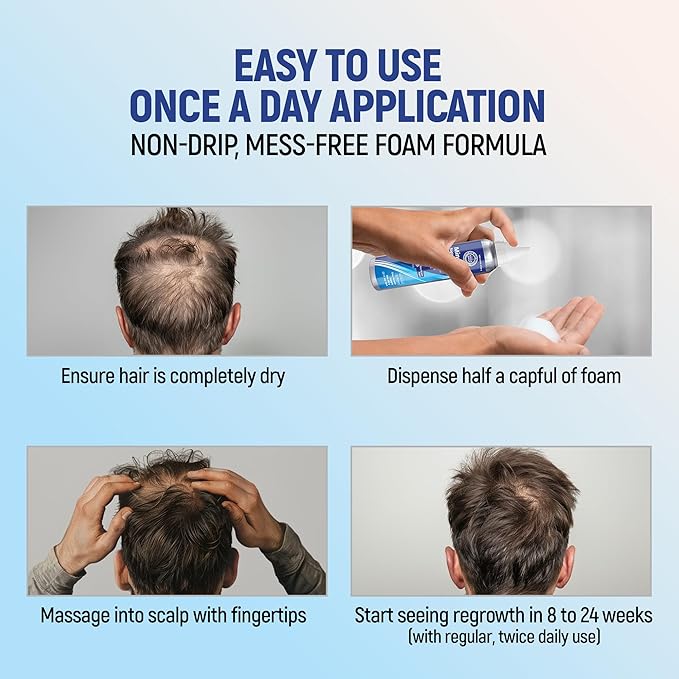 Minoxidil topical aerosol foam, 5%, hair regrowth 2 months treatment for men, 2.11 oz (2 Pack)