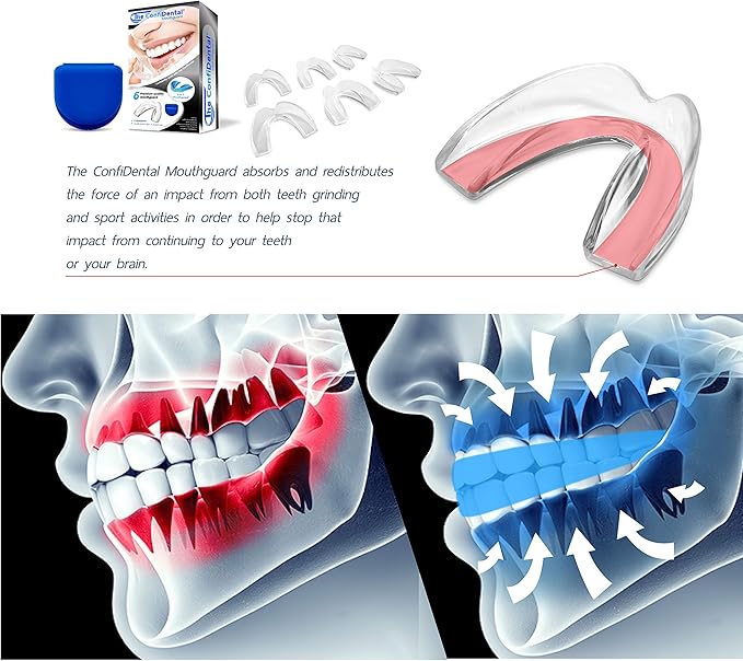 The ConfiDental - Pack of 6 Moldable Mouth Guard for Teeth Grinding Clenching Bruxism, Sport Athletic, Whitening Tray