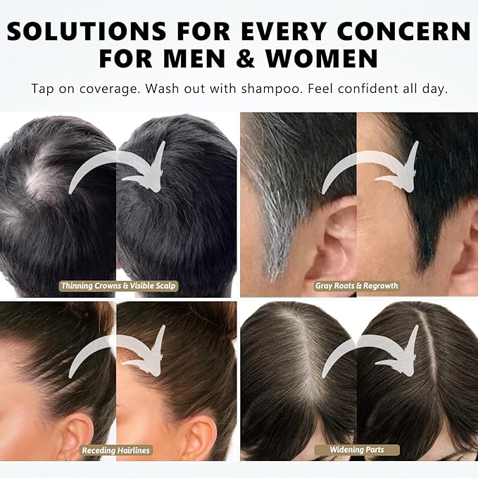 Root Touch Up Hair Color Powder, 3-Color Hairline Kit for Women & Men|Sweat Resistant&Nourishing, Instant Grey Coverage&Scalp Concealer, Natural Bald Spot Cover Up for Thinning Hair–Blonde