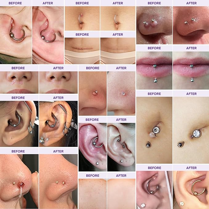 Keloid Bump Gel, Scar Prevention, Skin Renewal, Advanced Silicone Keloid Cream for Piercing Bumps 0.71 oz (2 Pack)