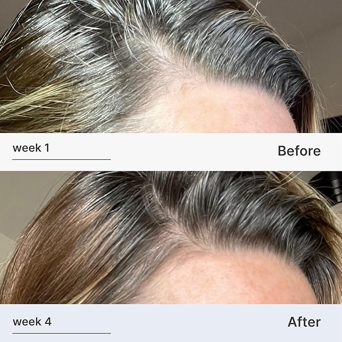 Better Not Younger Hair Thickening Serum for Women Over 40 – Scalp Care, Hair Density Treatment and Anti-Aging 2fl.oz – Fortifying Serum with Biotin & Ginger. Promotes Stronger, Thicker-Looking Hair.