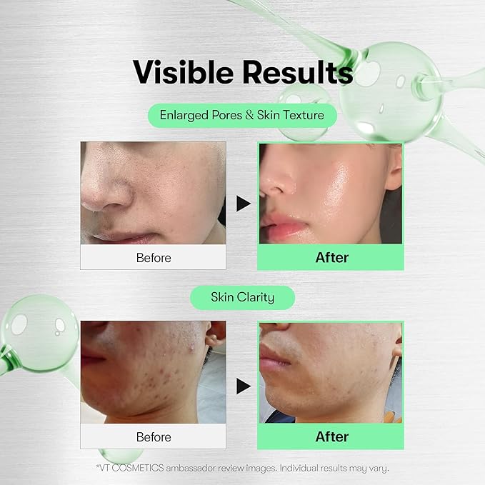 VT COSMETICS CICA Reedle Shot 100, Spicule Microneedling Serum for Pore Care & Exfoliation, Exosome, Centella Asiatica for Glass Skin, Skin Texture, Korean Liquid Skin Booster (1.69 Fl Oz / 50ml)