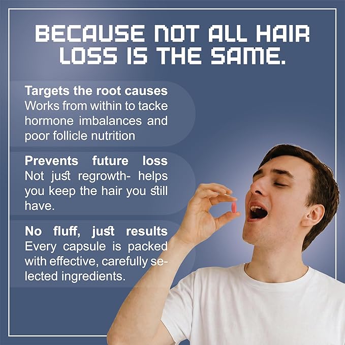Hair Growth Supplement | 360 Tablets - 6 Months Supply | Support Thicker, Fuller Healthy Hair Growth For Men & Women - Advanced Hair Growth 17 in 1 Formula