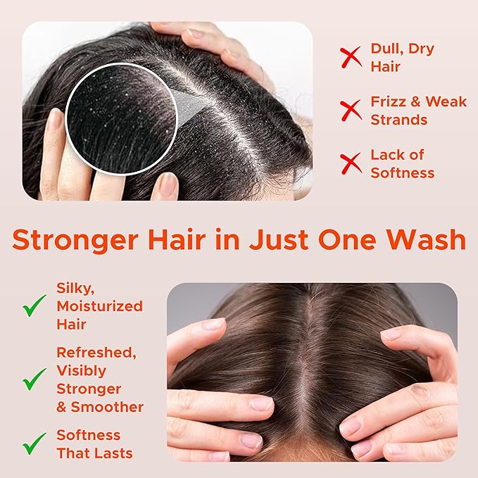 Nora Ross Garlic Extract & Rosemary Strengthening Shampoo and Conditioner Set – Natural Shampoo and Hair Conditioner for Normal to Dry, Brittle Hair – All Natural Scalp Cleanser Formula – 12 oz each