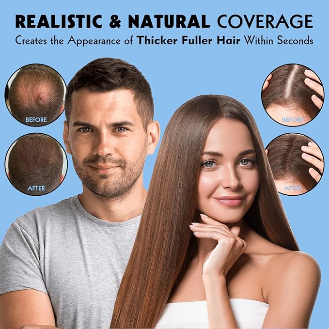 Hair Fibers for Thinning Hair - Hair Building Fibers for the Appearance of Thicker, Fuller Hair, Hair Thickening Fibers for Men and Women - Easy to Apply & Remove, 27.5g/ 0.97oz (Medium Blonde)