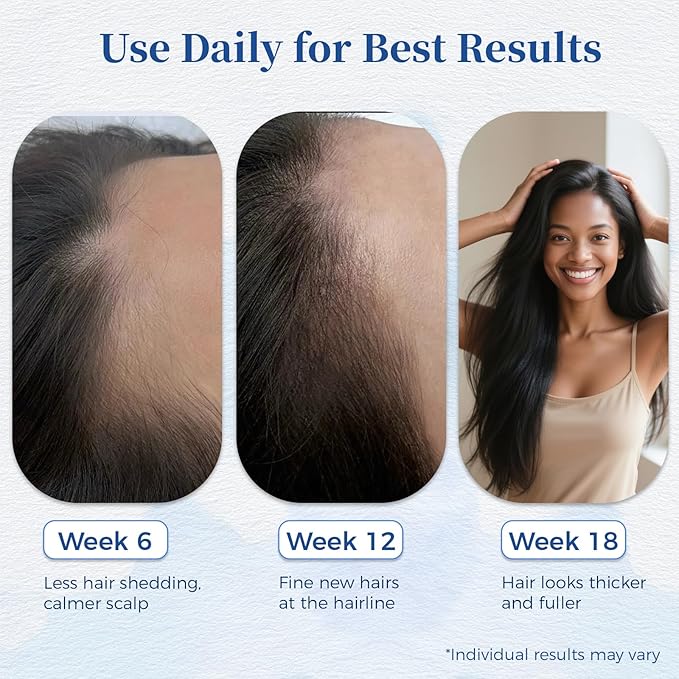 Hair Growth Serum Roll On 0.84Oz/25ml with Saw Palmetto, Rosemary & Pea Extract，Helps Support Thicker, Fuller Hair Appearance, Non-Greasy Hair Loss Support for Men & Women (1pcs)
