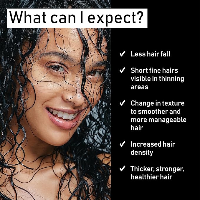 EVOLIS Reverse Scalp Activator - Hair Growth Serum - Scalp Serum & Hair Thickening Scalp Treatment for Fuller, Thicker Hair (1.7 fl oz)