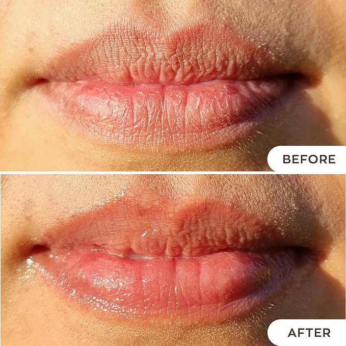 Hanalei Lip Treatment for Dry, Chapped Lips – Intensive Overnight Moisturizer with Kukui Oil, Shea Butter & Grapeseed Oil – Hydrating Balm for Healing Cracks – Clear Tint, Full-Size 15g – Cruelty-Free